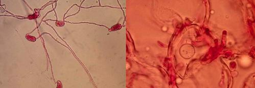 Fotos microscopio optico de Apresorios    y de   Haustorios